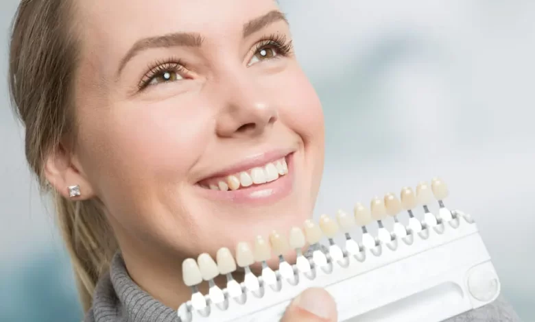 Die Wahrheit über Veneers