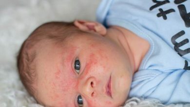 Allergiesymptome bei Kindern rechtzeitig erkennen