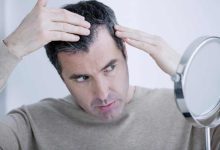 Die moderne Lösung für Männer mit Haarausfall
