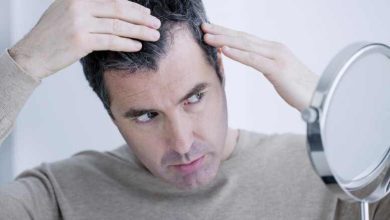 Die moderne Lösung für Männer mit Haarausfall