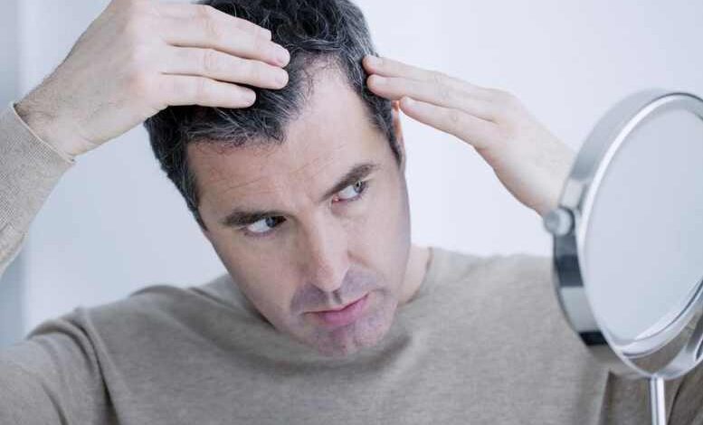 Die moderne Lösung für Männer mit Haarausfall